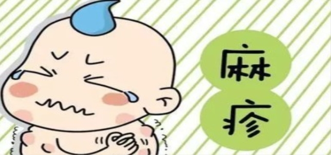 关于麻疹说法正确的是什么