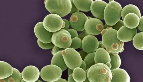 酵母菌是真核还是原核